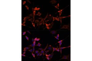 Immunofluorescence analysis of NIH-3T3 cells using S1/PR Polyclonal Antibody (ABIN6129890, ABIN6136741, ABIN6136742 and ABIN6221835) at dilution of 1:100 (40x lens). (PRAS40 抗体  (AA 152-276))