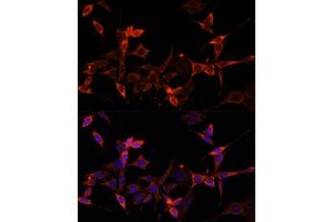 Immunofluorescence analysis of NIH-3T3 cells using S1/PR Polyclonal Antibody (ABIN6129890, ABIN6136741, ABIN6136742 and ABIN6221835) at dilution of 1:100 (40x lens). (PRAS40 抗体  (AA 152-276))