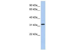 WB Suggested Anti-C15orf26 Antibody Titration: 0. (C15orf26/CFAP161 抗体  (C-Term))