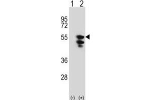 Western Blotting (WB) image for anti-Tu Translation Elongation Factor, Mitochondrial (Tufm) antibody (ABIN3001714) (TUFM 抗体)