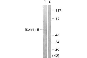 Western blot analysis of extracts from 293 cells treated with EGF (200ng/ml, 5mins), using Ephrin B (Ab-330) antibody (#B0010, Line 1 and 2). (EFNB1/2 (Tyr330) 抗体)