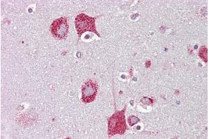 Immunohistochemistry with Brain, cortex tissue at an antibody concentration of 5µg/ml using anti-HEXA antibody (ARP61100_P050) (Hexosaminidase A 抗体  (C-Term))