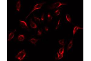 Immunofluorescence (fixed cells) (IF/ICC) image for anti-Estrogen Receptor 1 (ESR1) (pSer104) antibody (ABIN6256090)