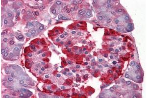 Human Pancreas: Formalin-Fixed, Paraffin-Embedded (FFPE) (CLIC1 抗体  (AA 1-242))
