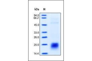 SDS-PAGE (SDS) image for CD3 epsilon (CD3E) (AA 23-126) (Active) protein (His tag) (ABIN2180778) (CD3 epsilon Protein (CD3E) (AA 23-126) (His tag))