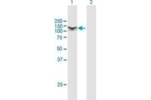 Western Blotting (WB) image for anti-Signal Transducer and Activator of Transcription 6, Interleukin-4 Induced (STAT6) (AA 1-847) antibody (ABIN950043)