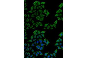 Immunofluorescence analysis of U2OS cells using TCN1 antibody. (TCN1 抗体)