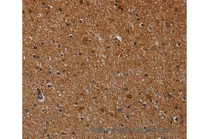 Immunohistochemistry of Human brain  using CYP1A2 Polyclonal Antibody at dilution of 1:40 (CYP1A2 抗体)
