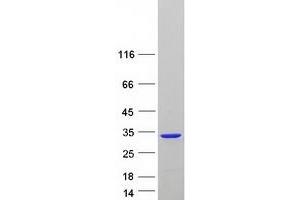 Validation with Western Blot
