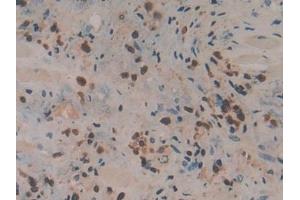 Immunohistochemistry (IHC) image for anti-Coronin, Actin Binding Protein, 1A (CORO1A) (AA 7-204) antibody (ABIN7436672)