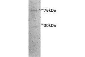 ABIN4902609 (1µg/ml) staining of Porcine MII Oocytes lysate (35µg protein in RIPA buffer). (DVL1 抗体)
