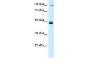 Image no. 1 for anti-T-Cell Activation rho GTPase-Activating Protein (TAGAP) (AA 202-251) antibody (ABIN6747648)