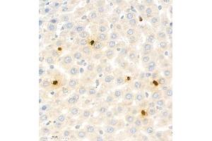 Immunohistochemistry (Paraffin-embedded Sections) (IHC (p)) image for anti-S100 Calcium Binding Protein A9 (S100A9) antibody (ABIN7075497)