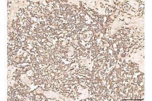 IHC analysis of BHMT using anti-BHMT antibody (ABIN7599940). (BHMT 抗体  (AA 13-386))