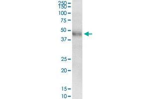 KRT8 MaxPab rabbit polyclonal antibody. (KRT8 抗体  (AA 1-483))