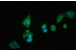 Immunofluorescent analysis of PC-3 cells using ABIN6953148 at dilution of 1:100 and Alexa Fluor 488-congugated AffiniPure Goat Anti-Rabbit IgG(H+L)