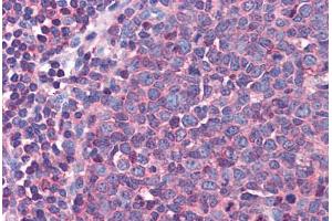 Human Tonsil: Formalin-Fixed, Paraffin-Embedded (FFPE) (Actin, gamma 1 抗体  (AA 1-119))