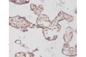 Immunohistochemistry of paraffin-embedded human placenta tissue using ABIN7145688 at dilution of 1:50 (BMP3 抗体  (AA 362-472))