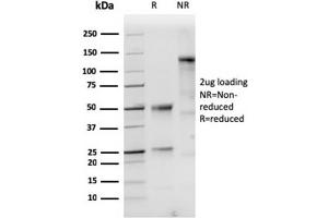 SDS-PAGE Analysis of Purified Cytokeratin 10 Rabbit Recombinant Monoclonal Antibody (KRT10/1948R). (Recombinant Keratin 10 抗体)