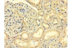 Immunohistochemistry of paraffin-embedded human kidney tissue using ABIN7143040 at dilution of 1:100 (ABLIM2 抗体  (AA 222-521))