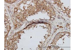 Image no. 1 for anti-phosphoinositide Kinase, FYVE Finger Containing (PIKFYVE) (AA 342-452) antibody (ABIN599337) (PIKFYVE 抗体  (AA 342-452))