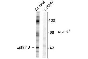Image no. 1 for anti-Ephrin B1 (EFNB1) (pTyr317) antibody (ABIN372620) (Ephrin B1 抗体  (pTyr317))