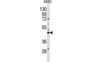 Western blot analysis of anti-SPHK1 Antibody (N-term) in K562 cell line lysates (35 µg/lane). (SPHK1 抗体  (N-Term))