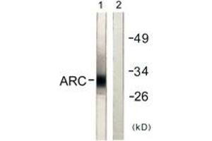 Western blot analysis of extracts from HeLa cells, using ARC Antibody. (ARC (AA 159-208) 抗体)