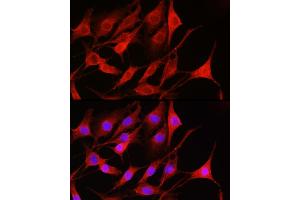 Immunofluorescence analysis of NIH-3T3 cells using Rac1/2/3 Rabbit pAb (ABIN6129317, ABIN6146616, ABIN6146618 and ABIN6223653) at dilution of 1:100 (40x lens). (RAC1 抗体  (AA 1-192))