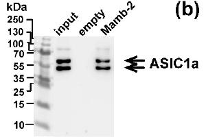 Western blot analysis of the ASIC1 subunits extraction from membrane fraction of mel P cells by affinity chromatography on NHS-sepharose resin coupled with mambalgin-2 (n = 3). (ASIC1 抗体  (Extracellular Domain))