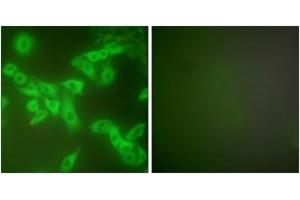 Immunofluorescence analysis of A549 cells, using Stefin B Antibody. (CSTB 抗体  (AA 49-98))