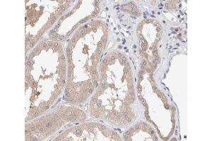 ABIN6267571 at 1/200 staining human kidney tissue sections by IHC-P. (SMAD3 抗体  (pSer425))