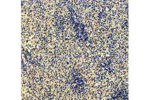 IHC analysis of CD79b using anti-CD79b antibody (ABIN3043398). (CD79b 抗体  (AA 29-229))