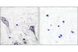Immunohistochemistry (IHC) image for anti-Patched 1 (PTCH1) (AA 1-50) antibody (ABIN1533374)