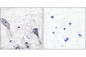 Immunohistochemistry analysis of paraffin-embedded human brain tissue, using Patched Antibody. (Patched 1 抗体  (AA 1-50))