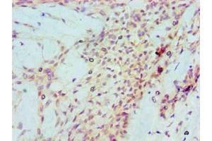 Immunohistochemistry (IHC) image for anti-Tumor Protein P53 (TP53) antibody (ABIN7172317)