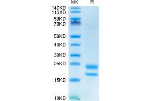VEGF121 Protein (AA 27-147) (His-Avi Tag)