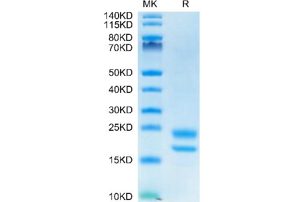 VEGF121 Protein (AA 27-147) (His-Avi Tag)