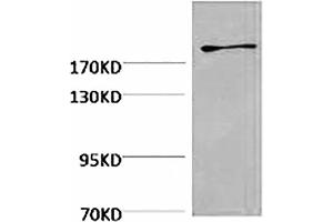 Western blot analysis of Hela, diluted at 1:2000. (Fibronectin 抗体)
