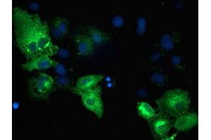 Anti-TBC1D4 mouse monoclonal antibody (ABIN2454446) immunofluorescent staining of COS7 cells transiently transfected by pCMV6-ENTRY TBC1D4 (RC212105). (TBC1D4 抗体)