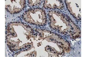 Image no. 6 for anti-Transforming, Acidic Coiled-Coil Containing Protein 3 (TACC3) antibody (ABIN1498095) (TACC3 抗体)