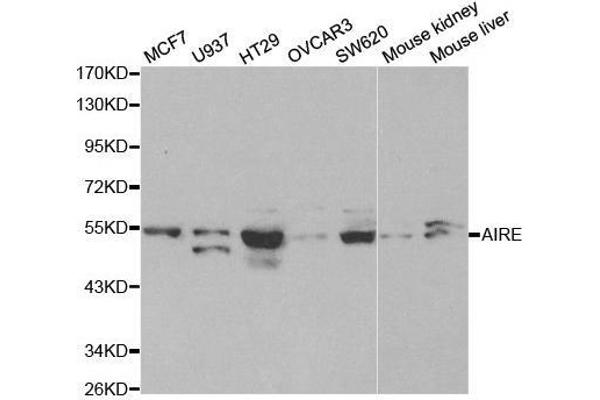 AIRE 抗体  (AA 30-130)