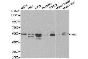 Western blot analysis of extracts of various cell lines, using AIRE antibody. (AIRE 抗体  (AA 30-130))