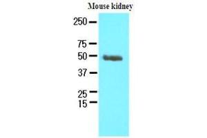 Western Blotting (WB) image for anti-Proteasome (Prosome, Macropain) 26S Subunit, Non-ATPase, 11 (PSMD11) (AA 1-422) antibody (ABIN933037)