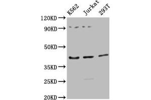 Western Blot Positive WB detected in: K562 whole cell lysate, Jurkat whole cell lysate, 293T whole cell lysate All lanes: ADIPOR1 antibody at 1:2500 Secondary Goat polyclonal to rabbit IgG at 1/50000 dilution Predicted band size: 43 kDa Observed band size: 43 kDa (Adiponectin Receptor 1 抗体  (AA 1-63))