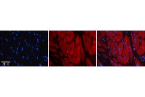 Rabbit Anti-KHSRP Antibody    Formalin Fixed Paraffin Embedded Tissue: Human Adult heart  Observed Staining: Cytoplasmic Primary Antibody Concentration: 1:100 Secondary Antibody: Donkey anti-Rabbit-Cy2/3 Secondary Antibody Concentration: 1:200 Magnification: 20X Exposure Time: 0. (KHSRP 抗体  (Middle Region))