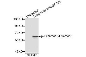 Western blot analysis of extracts of NIH3T3 cells, using Phospho-FYN-Y416/Lck-Y416 antibody (ABIN5995595). (FYN 抗体  (pTyr416))