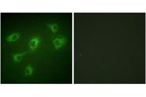 Immunofluorescence analysis of HuvEc cells, using TGF beta Receptor III Antibody. (TGFBR3 抗体  (AA 111-160))