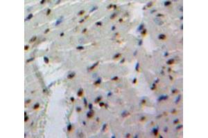 Used in DAB staining on fromalin fixed paraffin-embedded Heart tissue (EBF1 抗体  (AA 179-451))