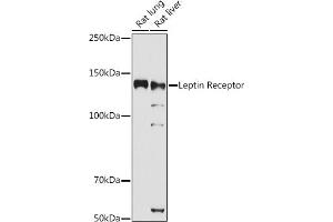 Western blot analysis of extracts of various cell lines, using Leptin Receptor antibody (ABIN3017145, ABIN3017146, ABIN3017147 and ABIN6219976) at 1:1000 dilution. (Leptin Receptor 抗体)